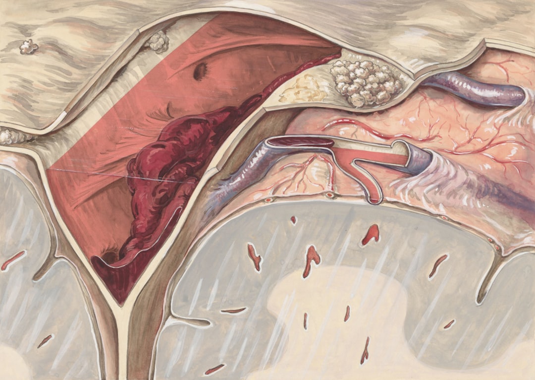 Understanding Atrial Fibrillation: Causes, Symptoms, and Management